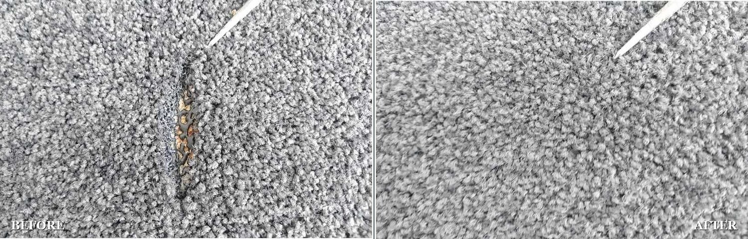 Burn repair: before and after
